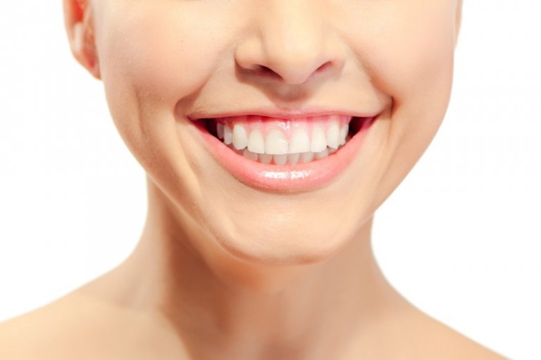 sonrisa gingival tratamiento facial