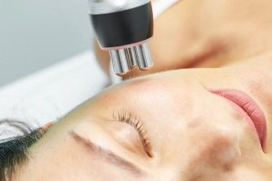 radiofrecuencia facial tratamiento estetico