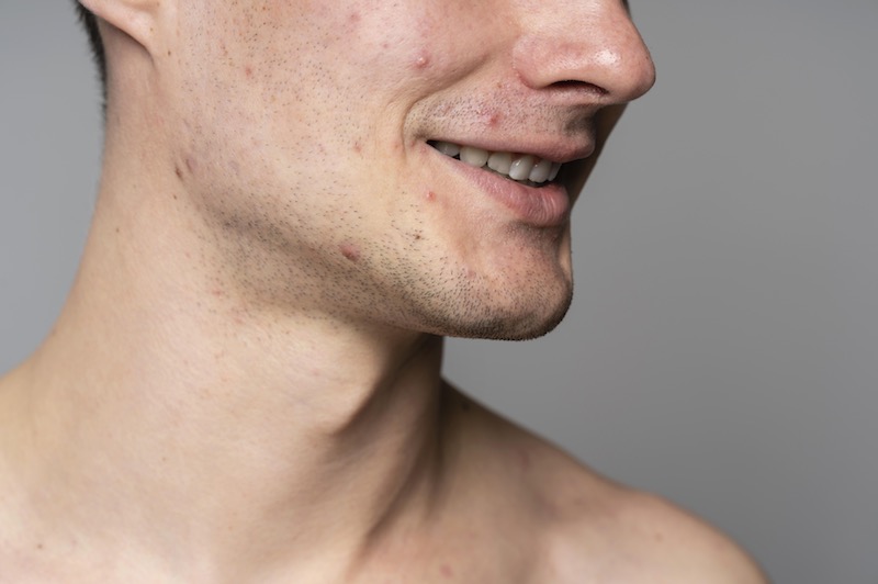 secret duo para rejuvenecimiento facial