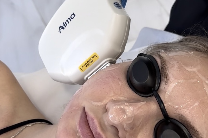 Láser Harmony XL Pro para Rejuvenecer