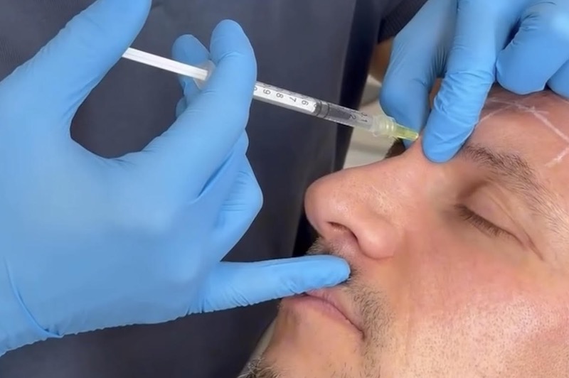 Neuromoduladores todo lo que debes saber