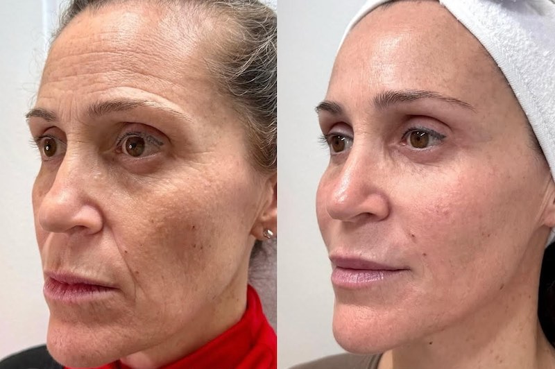 ¿son seguros los tratamientos estéticos?