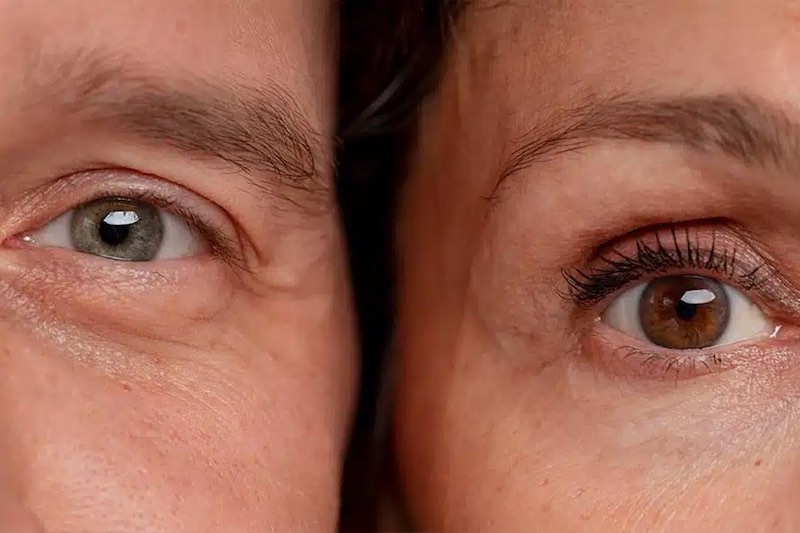 Polinucleóticos en Barcelona