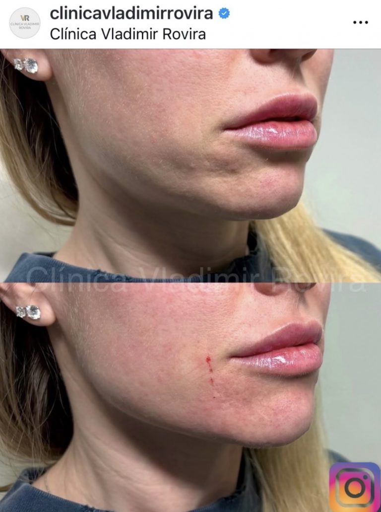 Instagram clínica vladimir rovira
